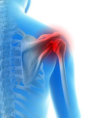 Baseball and Shoulder Injuries