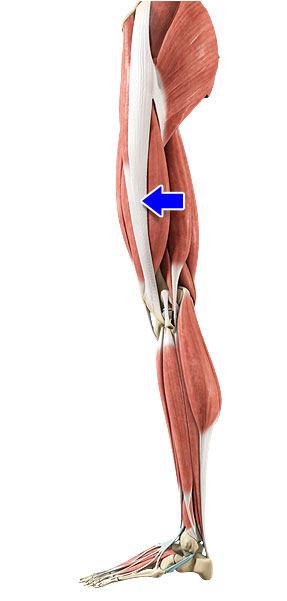 Iliotibial Band Syndrome Fort Worth, TX  Athletic Injury Treatment  Weatherford, Aledo TX