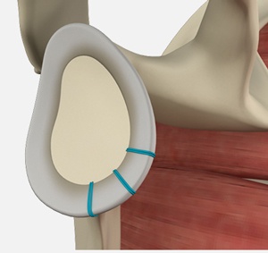 labrum