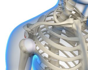 Multidirectional Instability of the Shoulder