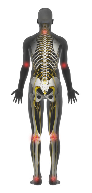 Muscle and Joint Pain